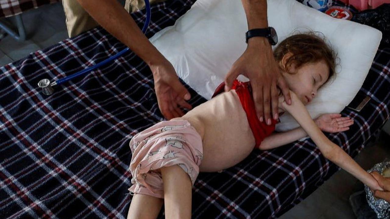 Gadis berusia 5 tahun ini memiliki berat hanya 9 kilogram.&nbsp;Dia saat ini menjalani perawatan di klinik lapangan Korps Medis Internasional (IMC).