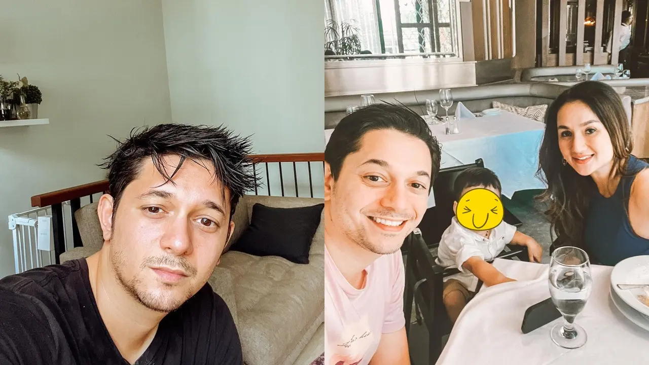 Kumis dan Brewok Tipis Andrew Andika
