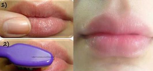 Gula juga bisa digunakan untuk mencerahkan bibir./Copyright healttreatcure.org