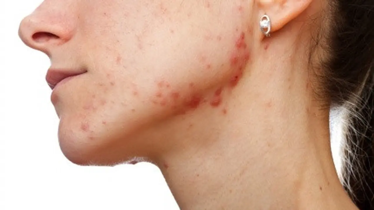 Dermatologis