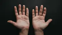 Bangun Tidur Tangan Kaku dan Bengkak? Bisa Jadi Tanda Rheumatoid Arthritis