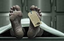 Pria Ditemukan Tewas dengan Kondisi Kaki Sisa Tulang di Kebun Warga