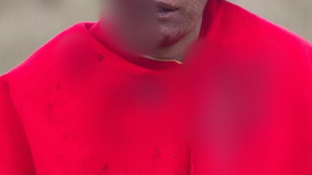 Seorang pejuang dari komunitas Canas mengalami cedera saat ia mengambil bagian dalam Luchas de Toqto.<br>Foto: REUTERS / Oswald Charca<br>