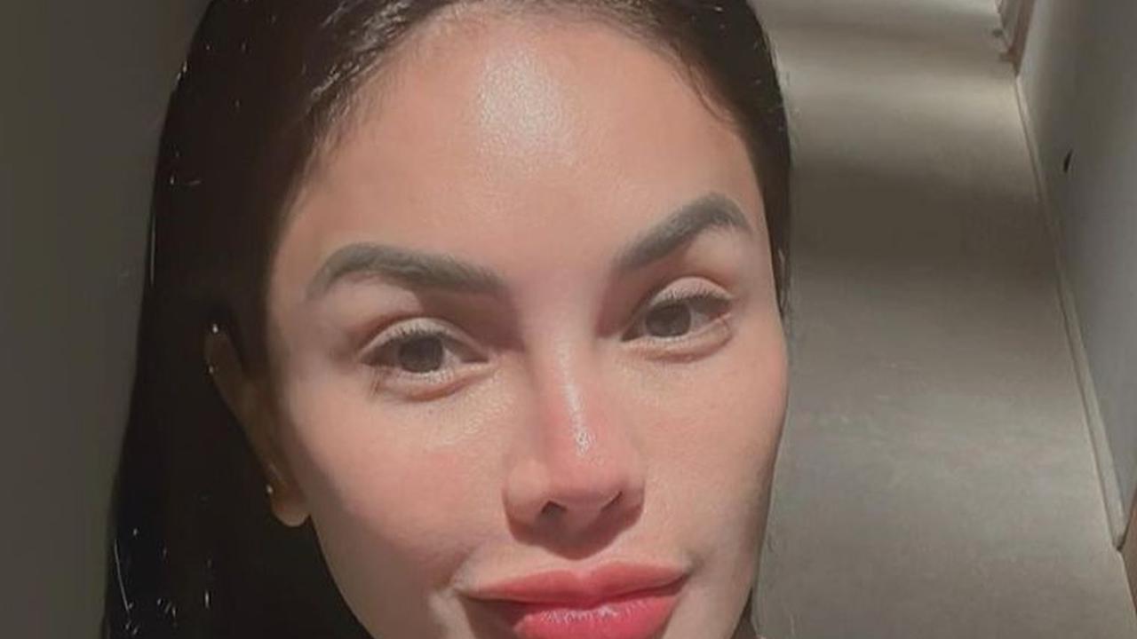 Treatment Botox <br>