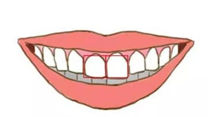 Ilustrasi gigi depan (Sumber: Lols.me)