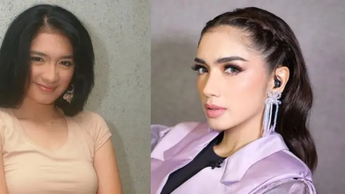 Potret 10 Artis Ini Jalani Operasi untuk Penampilan Lebih Sempurna, Aslinya Cantik Sejak Kecil