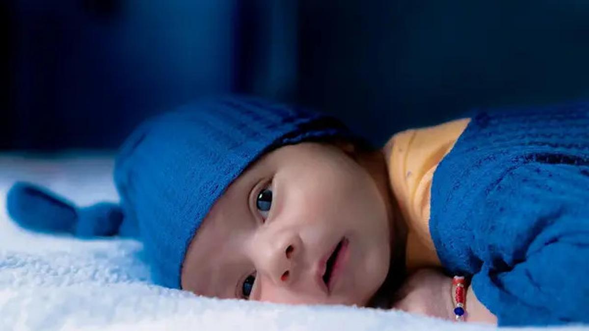 Mengenal Cutis Laxa, Gangguan Langka yang Membuat Kulit Bayi Berkeriput