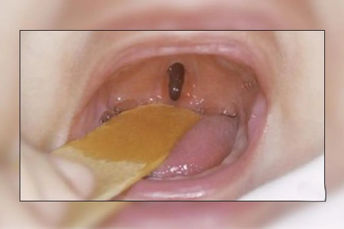 bibir-sumbing121214b.jpg