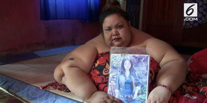 VIDEO: Rawan Penyakit, Wanita Obesitas 300 Kg Butuh Bantuan