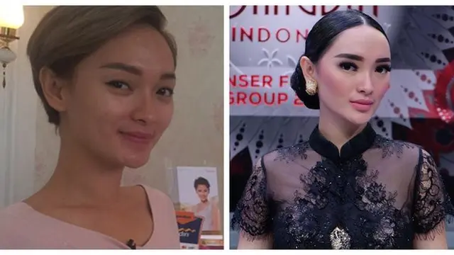 Bukan Oplas, Ini Transformasi 7 Penyanyi Dangdut yang Memesona Usai Tanam Benang