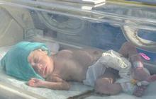 FOTO: Potret Puluhan Bayi Prematur Tanpa Orang Tua Dievakuasi dari RS Al-Shifa Gaza ke Mesir