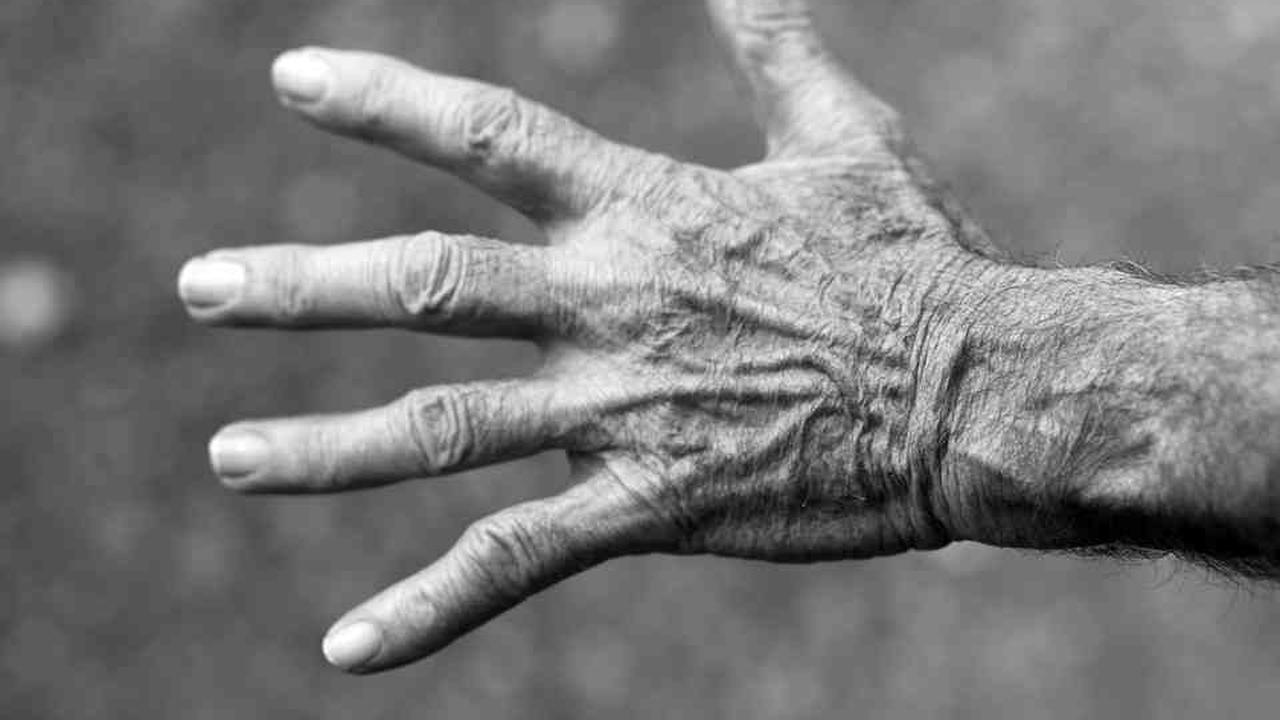 Pemilik Warung Kopi Polisikan Pelanggannya, Aniaya Hingga Jari Putus