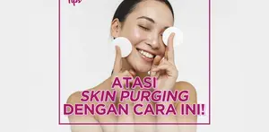 Bagaimana atasi skin purging akibat mencoba skincare baru? Yuk intip videonya!