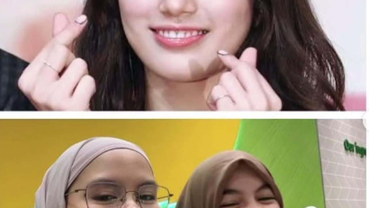 Umbar Senyum Mirip Bae Suzy