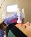 Cara Mengencangkan Kulit Wajah dengan H2O Facial di Klinik Kecantikan.&nbsp; foto: istimewa