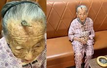 Kejadian Langka! Dahi Nenek 107 Tahun Tumbuh Tanduk Sampai jadi Perbincangan, Disebut Bikin Panjang Umur