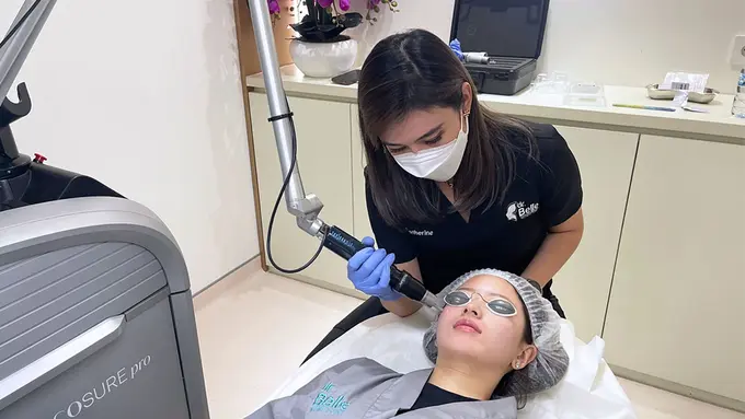 Hempaskan flek hitam di wajah