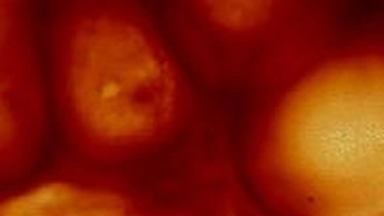 3. Kompleksitas Peran Cyanobacteria<br>