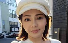Hasilnya Jadi Sorotan, Pengakuan Maya Septha Lakukan Beauty Surgery di Korea Selatan