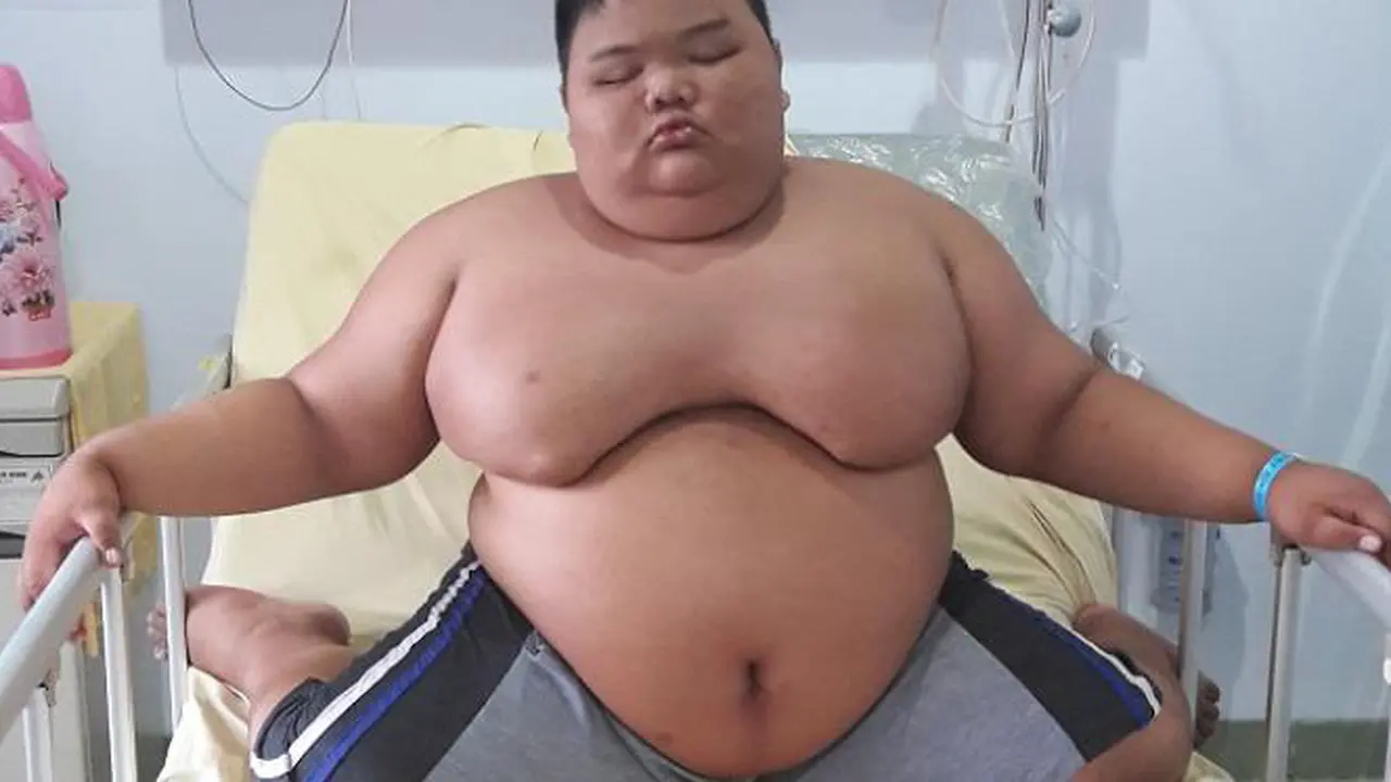Top 3: Meski Koma, Rizki Bocah Obesitas Merespon Suara Ibunda