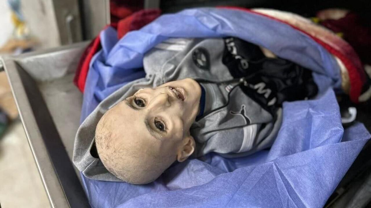 Kisah Pilu Bocah Gaza yang Meninggal Karena Kelaparan, "Tak Perlu Keajaiban Untuk Menyelamatkannya, Dia Hanya Butuh Makan!"