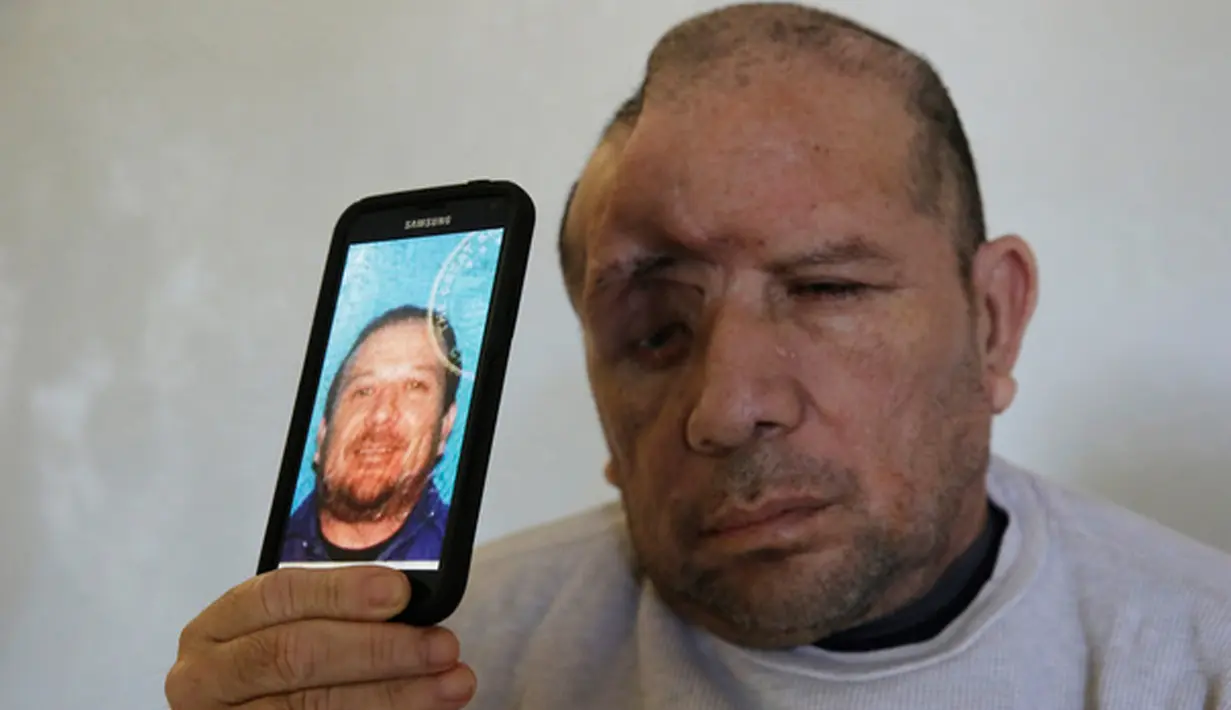 Walter DeLeon menunjukkan foto di SIM-nya di Covina, California, Rabu (2/12/2015). Pria 49 tahun itu kehilangan seperempat tempurung kepalanya setelah ditembak oleh petugas kepolisian Los Angeles pada 19 Juni lalu. (AP/Chris Carlson/Dailymail)