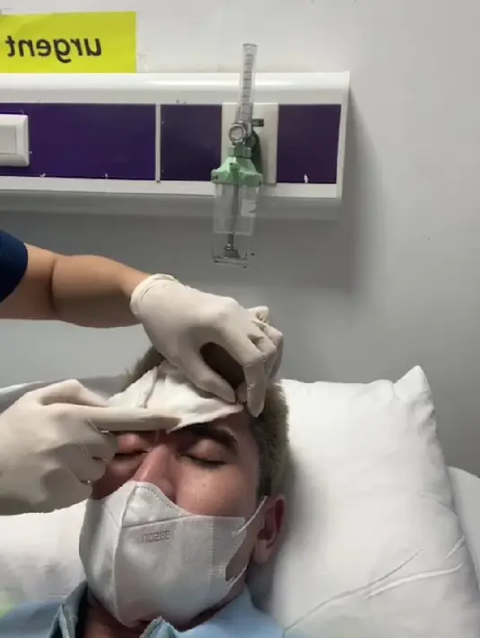 Verrell Bramasta saat menjalani proses jahitan karena alisnya robek akibat terbentur sangat keras. (Instagram @bramastavrl)