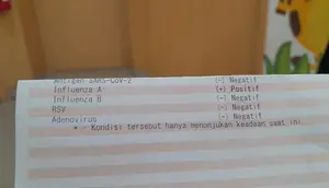 Gejala Influenza A, Tak Cuma Demam