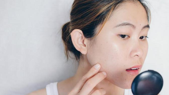 Penyebab Jerawat Pipi Pada Perempuan Usia 25 Tahun Ke Atas Beauty Fimela Com