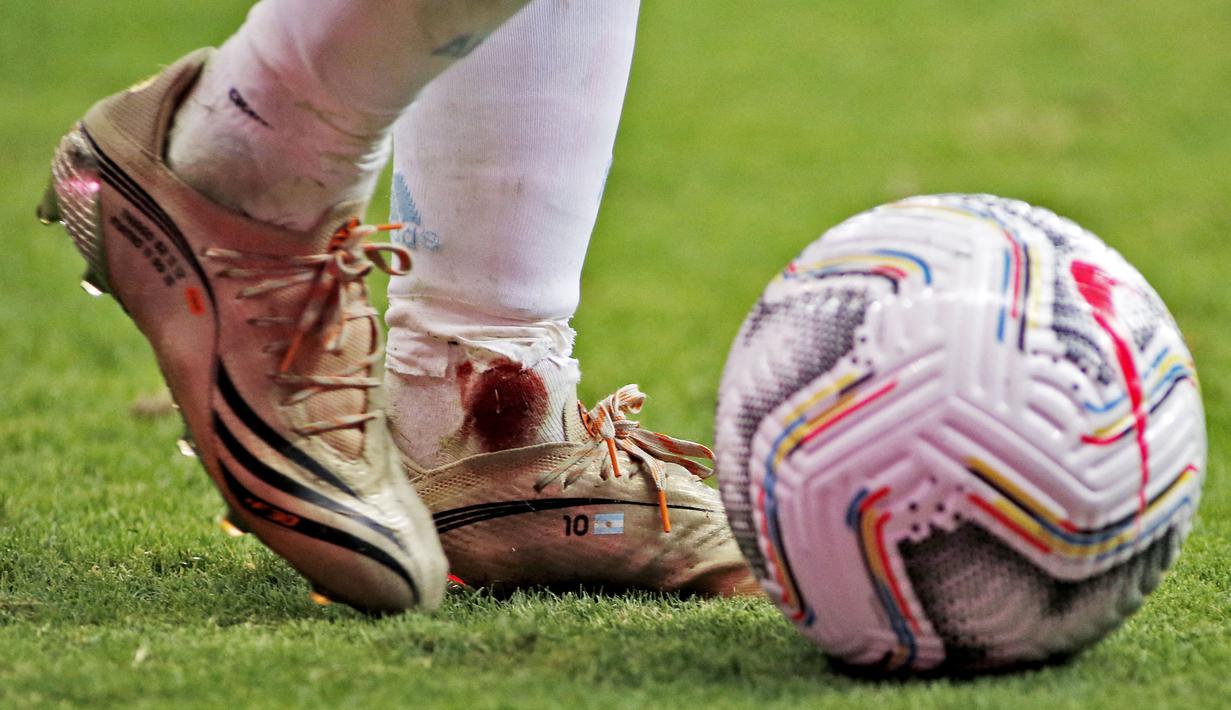 Tampak darah merembes dari kaus kaki Lionel Messi. (Foto:AFP/Silvio Avila)