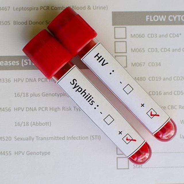 8 Penyakit Menular Seksual Dan Cara Pencegahannya Wajib Tahu Hot Liputan6 Com