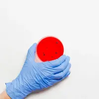 Ilustrasi ilmuwan sedang meneliti virus cacar monyet. Credits: pexels.com by Anna Shvets