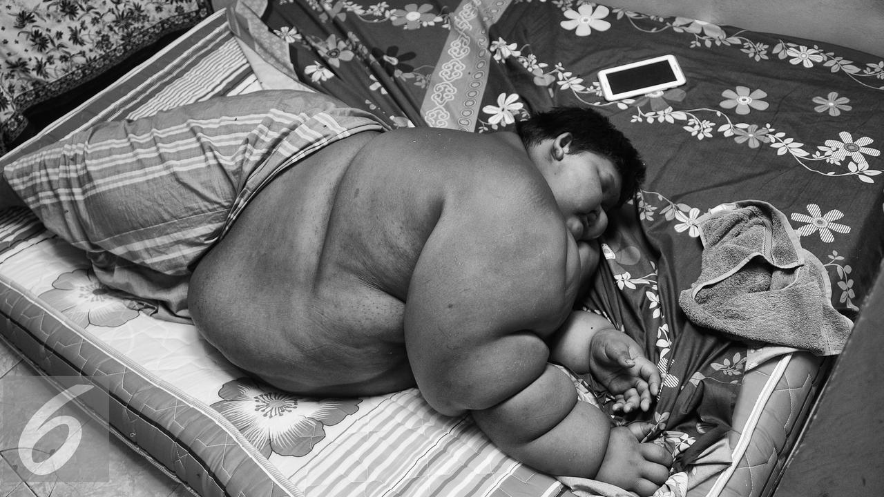 20160630-Obesitas-Ariya-Permana-GMS