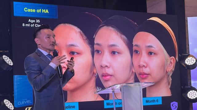 Dermatologis asal Taiwan dokter Shang Li Lin menjelaskan tentang penggunaan filler penstimulus kolagen. Yang bantu agar wajah terlihat lebih bervolume dalam jangka waktu lama dan tampak alami.