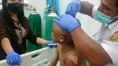Bocah Kakak Beradik di Sidikalang Jadi Korban Penyiksaan Sadis