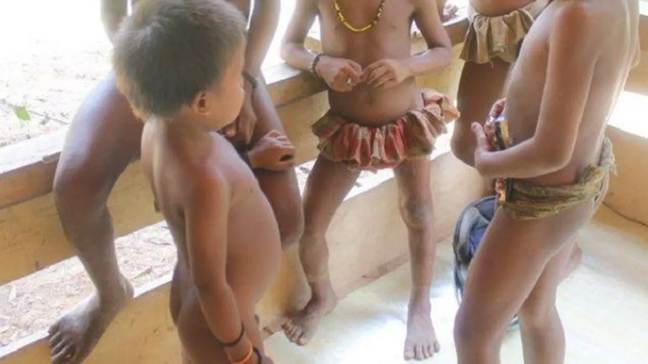 Derita Balita Rimba Jambi Meninggal Akibat Komplikasi