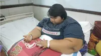 Yunita Maulidia (19) warga Desa Grinting Kecamatan Tulangan, yang memiliki berat badan 142 Kg, yang sedang menjalani perawatan karwna obesitas di RSUD Sidoarjo, meninggal dunia. (Liputan6.com/Dian Kurniawan)
