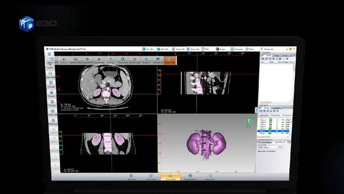 Teknologi 4.0 Berbasis 3D Print Terobosan Baru di Dunia Kesehatan