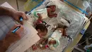 Pada Minggu, WHO mengatakan 31 bayi prematur dalam “kondisi sangat kritis” telah dievakuasi dari rumah sakit terbesar di Gaza dan akan dipindahkan ke Mesir untuk mendapatkan perawatan khusus. (AP Photo/Fatima Shbair)