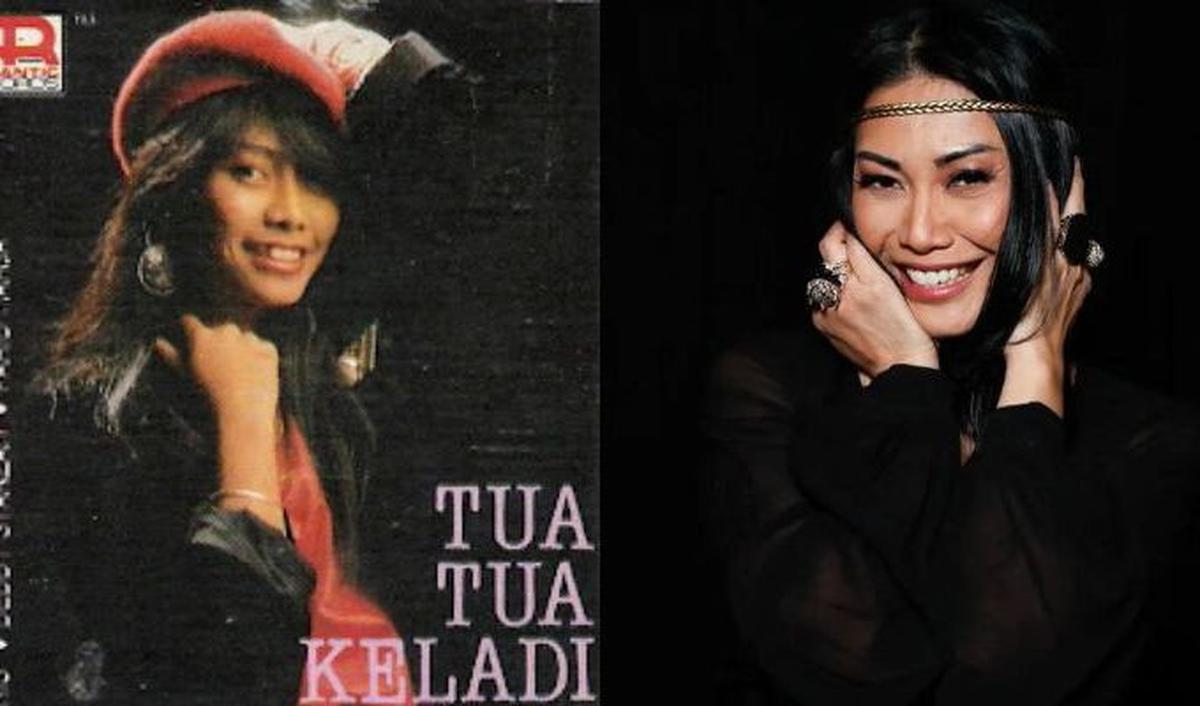 Anggun C. Sasmi, sebelum terkenal di panggung internasional, memiliki gigi gingsul yang menjadi ciri khasnya.&nbsp;