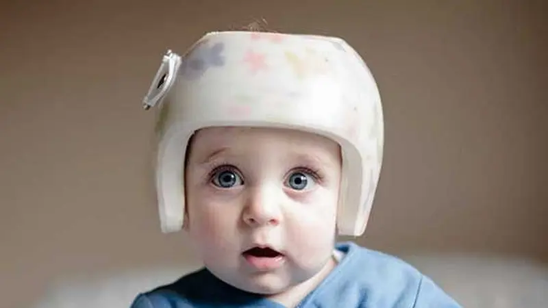Tren Baru di China, Pasangkan Helm ke Bayi Agar Bentuk Kepala Membulat