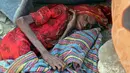 Kondisi seorang wanita lansia akibat kekurangan gizi saat beristirahat di kamp pengungsi di selatan Taez, Yaman (11/1). WHO mencatat sebanyak 2,1 juta orang telah terlantar akibat konflik yang terjadi di Yaman. (AFP Photo/Ahmad Al-Basha)