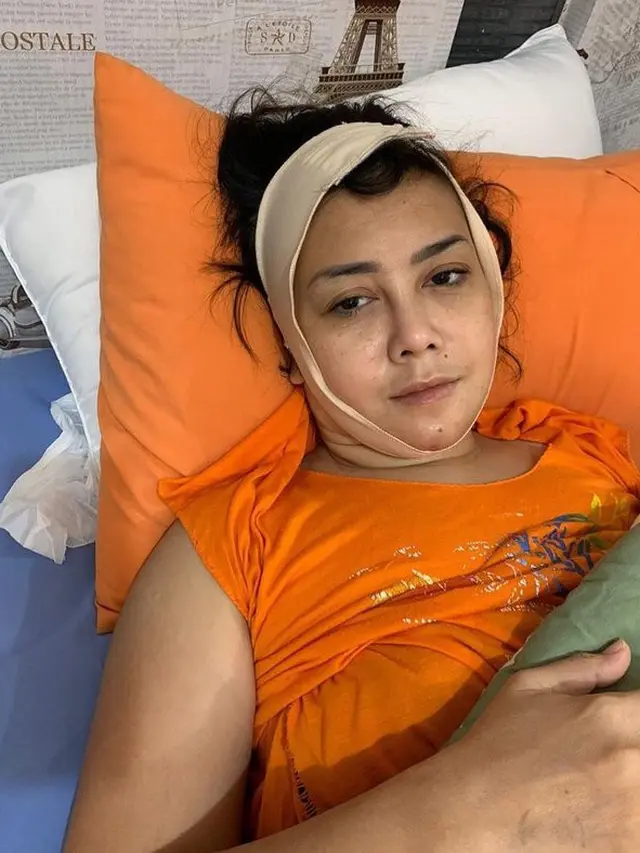 5 Potret Rency Milano Diduga Jadi Korban Malpraktik, Dagu Bengkak dan Bernanah