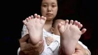 Bayi Berjari 31 di China Ini Butuh Uluran Tangan
