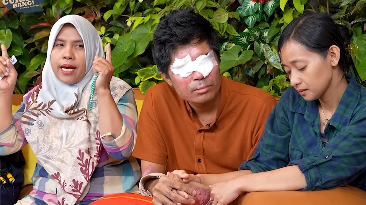 BPJS Kesehatan Buka Suara soal Tak Lagi Tanggung Biaya Pengobatan Agus Salim Korban Penyiraman Air Keras