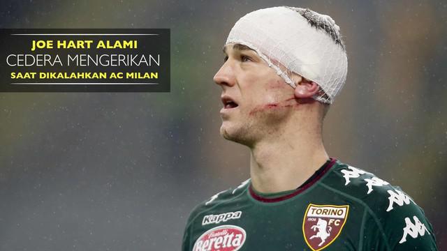 Joe Hart mengalami cedera di bagian kepala saat Torino dikalahkan AC Milan 1-2 di babak 16 besar Coppa Italia