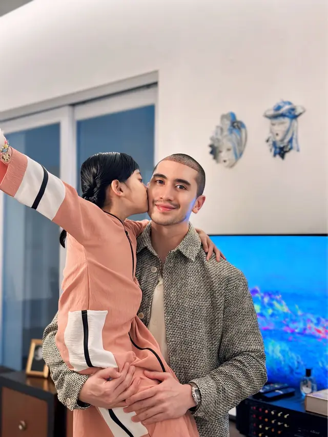 Verrell Bramasta lakukan transplantasi rambut.