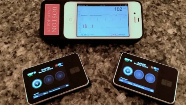 Aplikasi iPhone untuk pemantauan pankreas bionik. (Sumber Healthline)