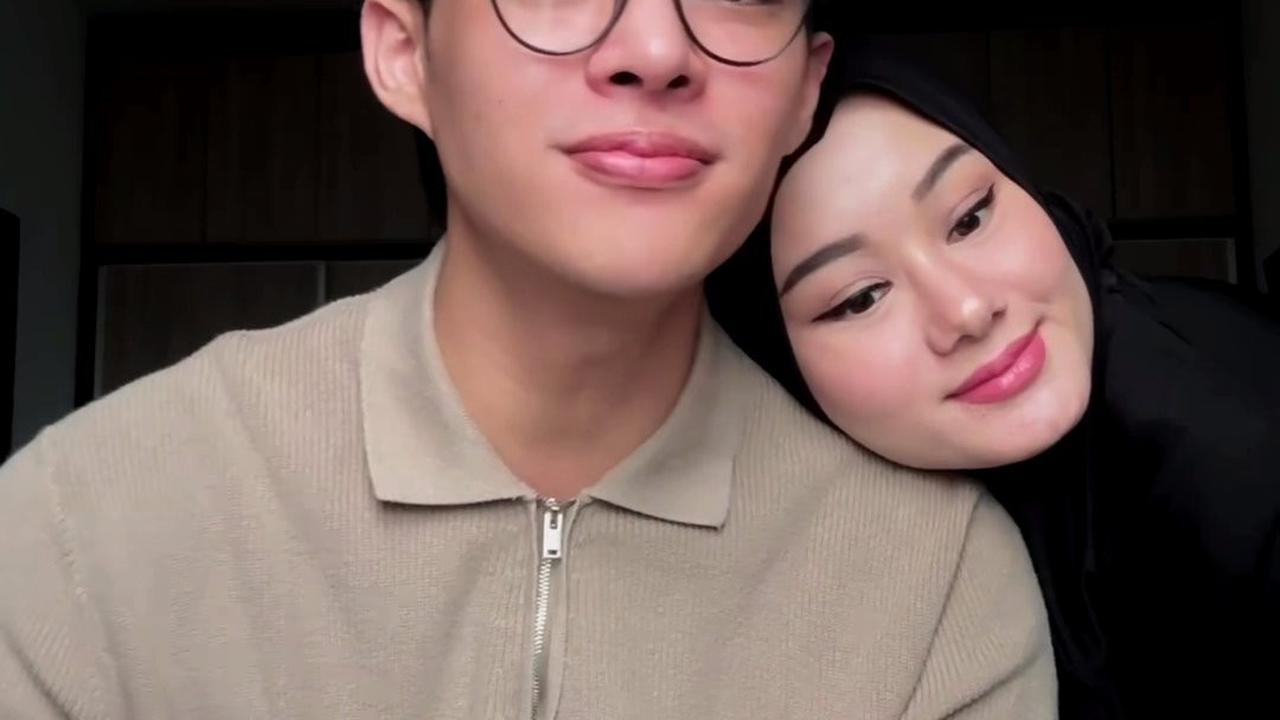 7 Potret Terbaru Rey Mbayang yang Benarkan Oplas Hidung, Alasannya Masalah Kesehatan