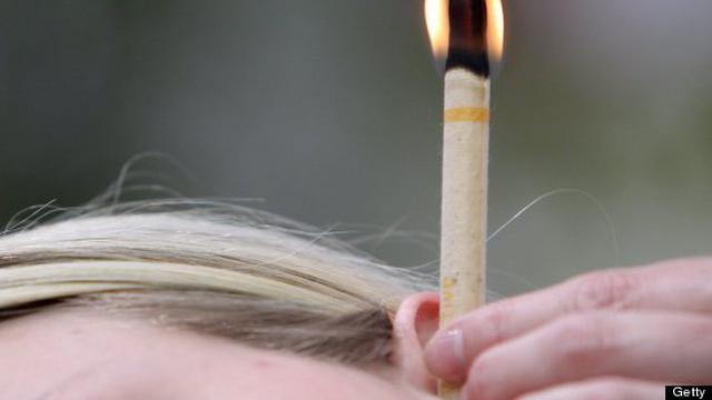 Terapi Ear Candle, Metode Kesehatan Paling Bodoh yang Pernah Ada - Health  Liputan6.com